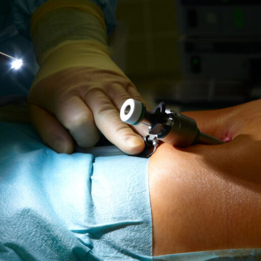 Preparing a laparoscopic surgery in a german hospital.